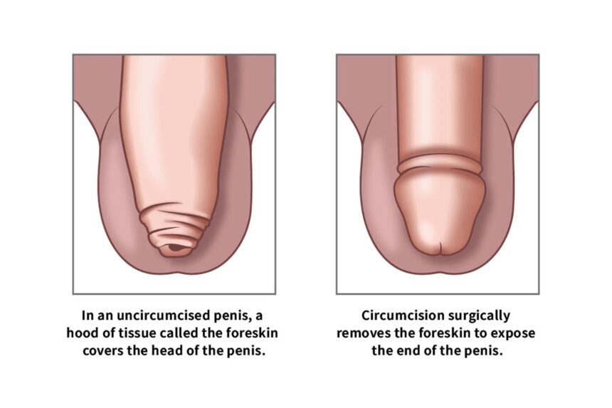 Kennedy Sets the Record Straight on Circumcision, Autism, and Tylenol Controversies